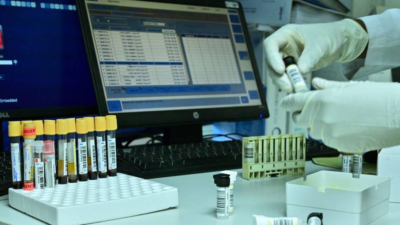 WADA-Boss fordert harte Maßnahmen