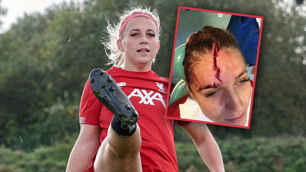 Horror-Verletzung bei Reds-Keeperin