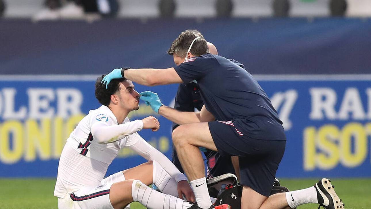 Englands U21 raus – DFB-Gegner fix