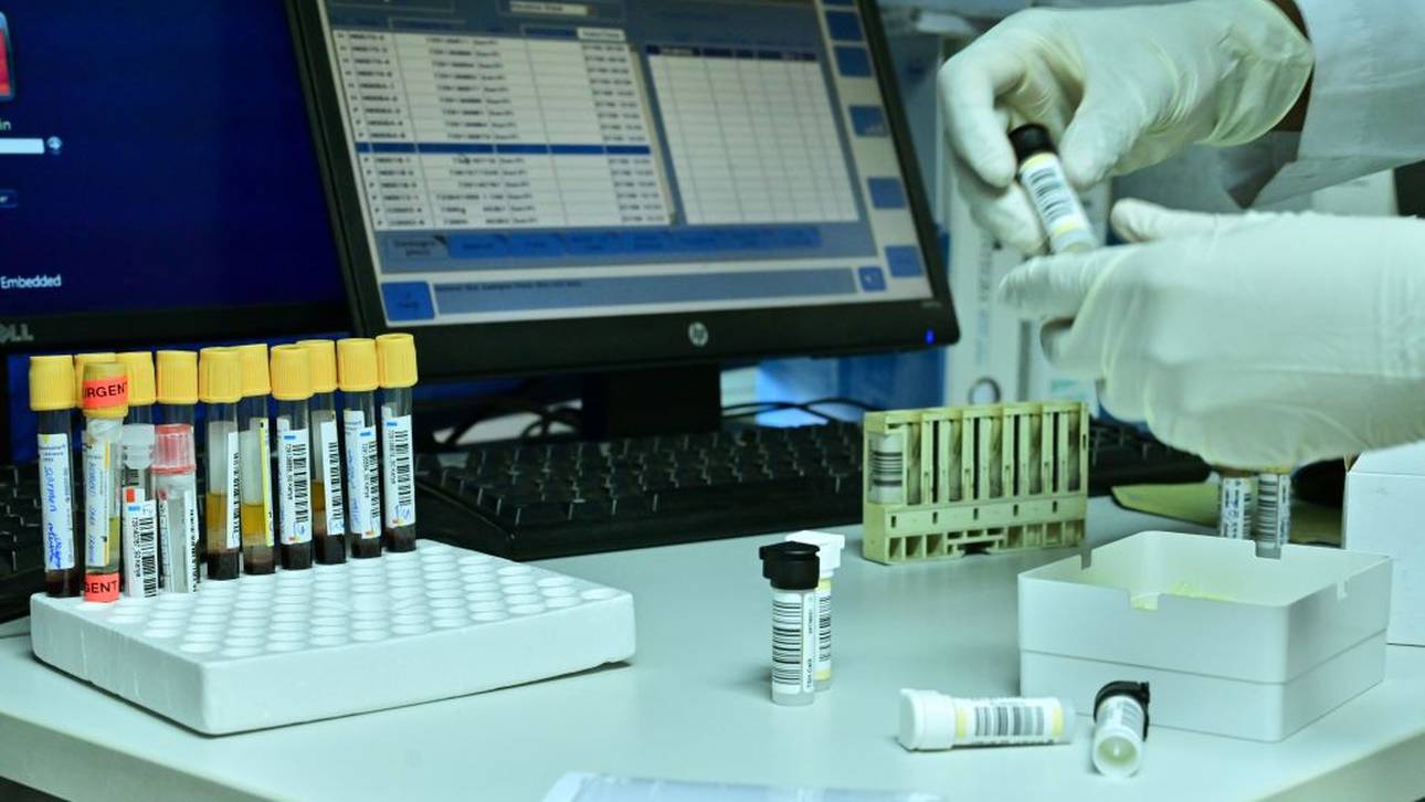 WADA will Anhörung beim CAS