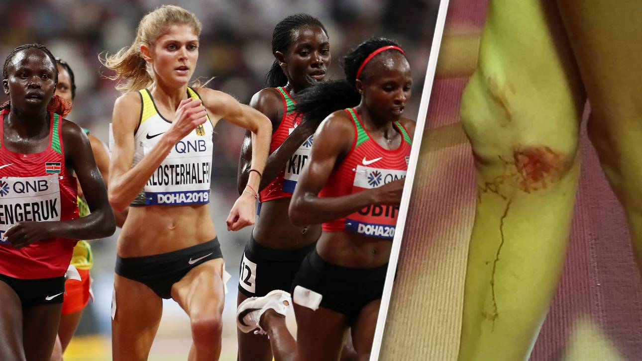 „Koko“ trotzt den Schmerzen