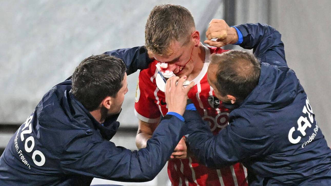 Matthias Ginter mit dem Cut am Auge