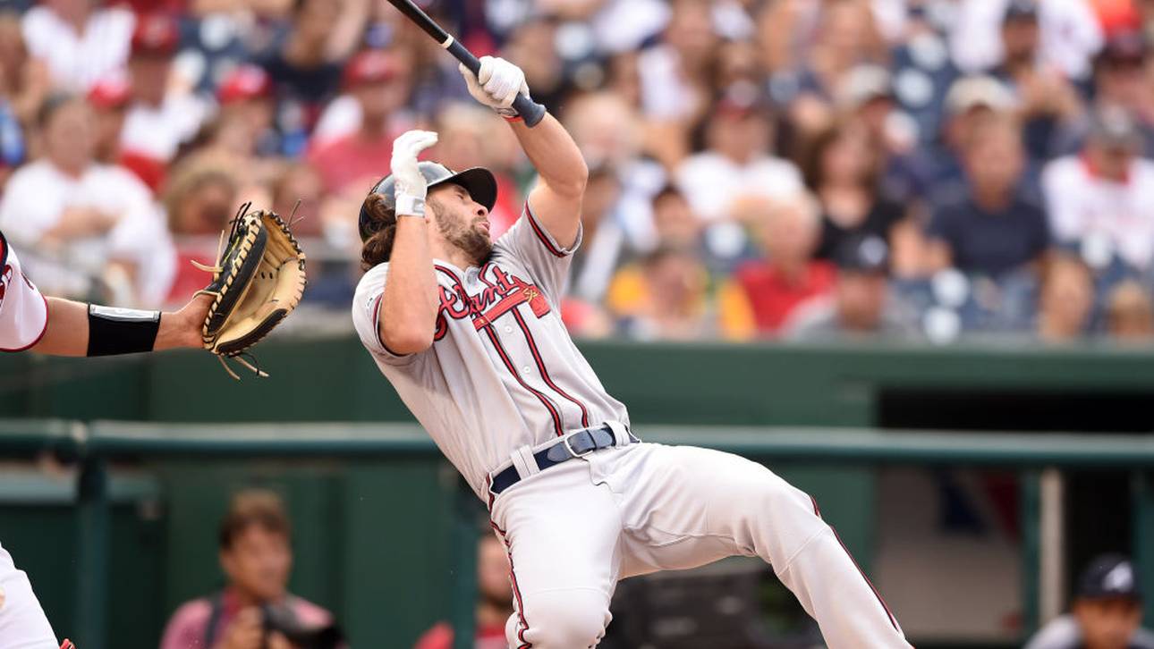 MLB-Profi bekommt 145 km/h-Ball ab