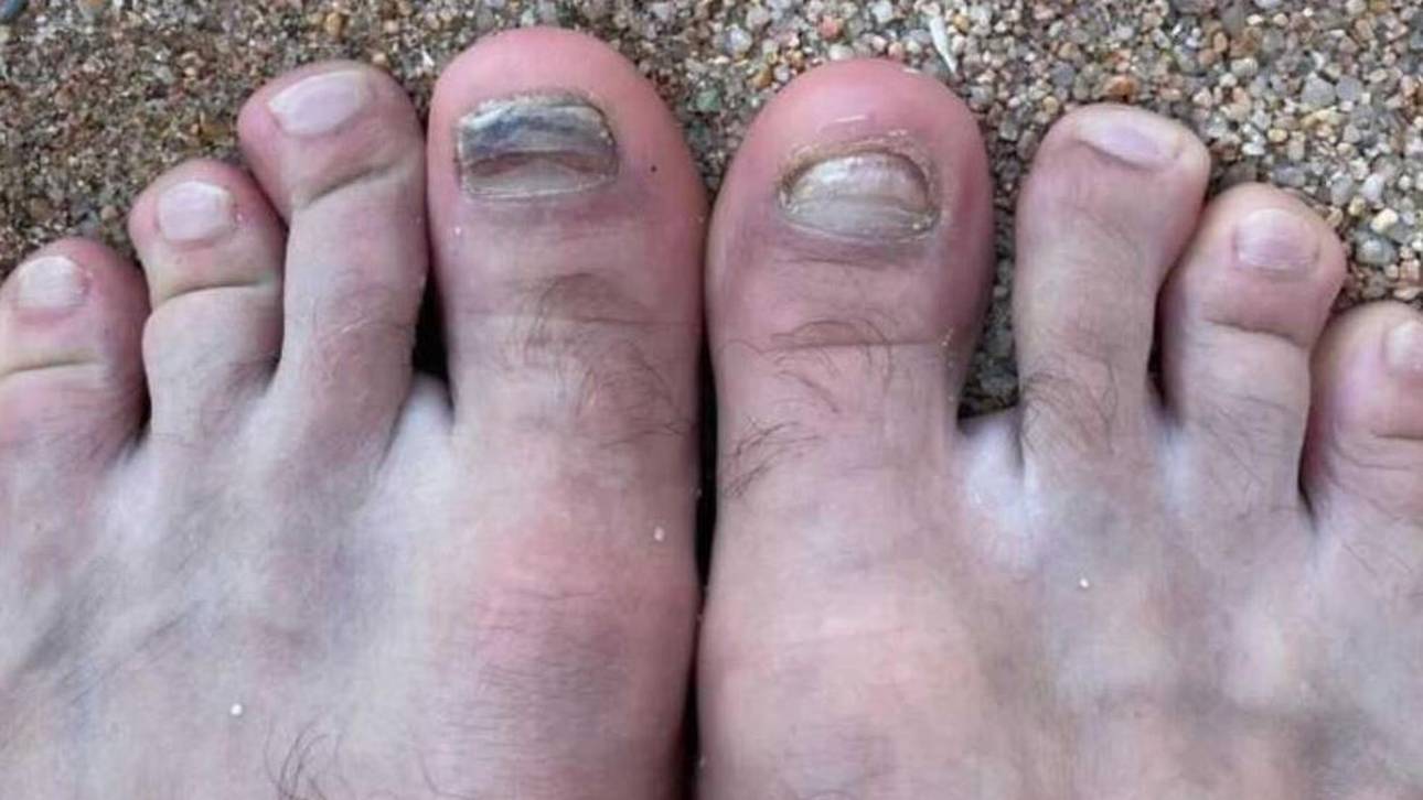 Diese Füße gehören einem Bayern-Star