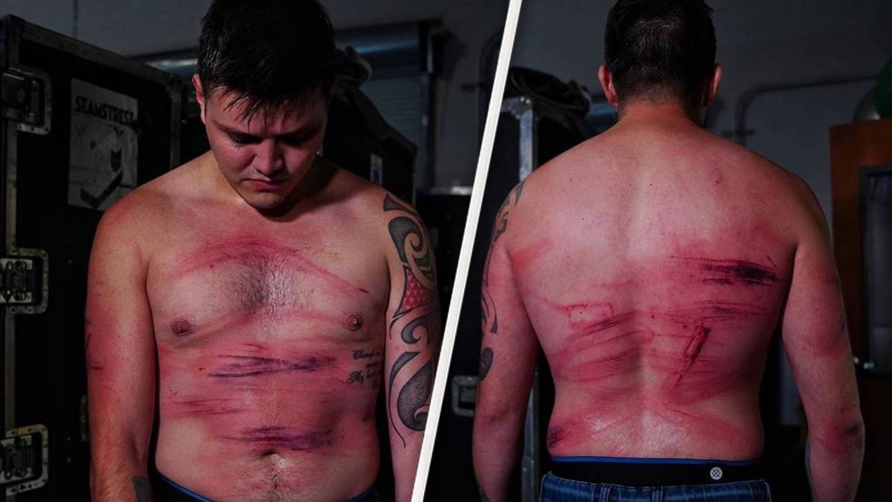 So übel wurde Reys Sohn zugerichtet