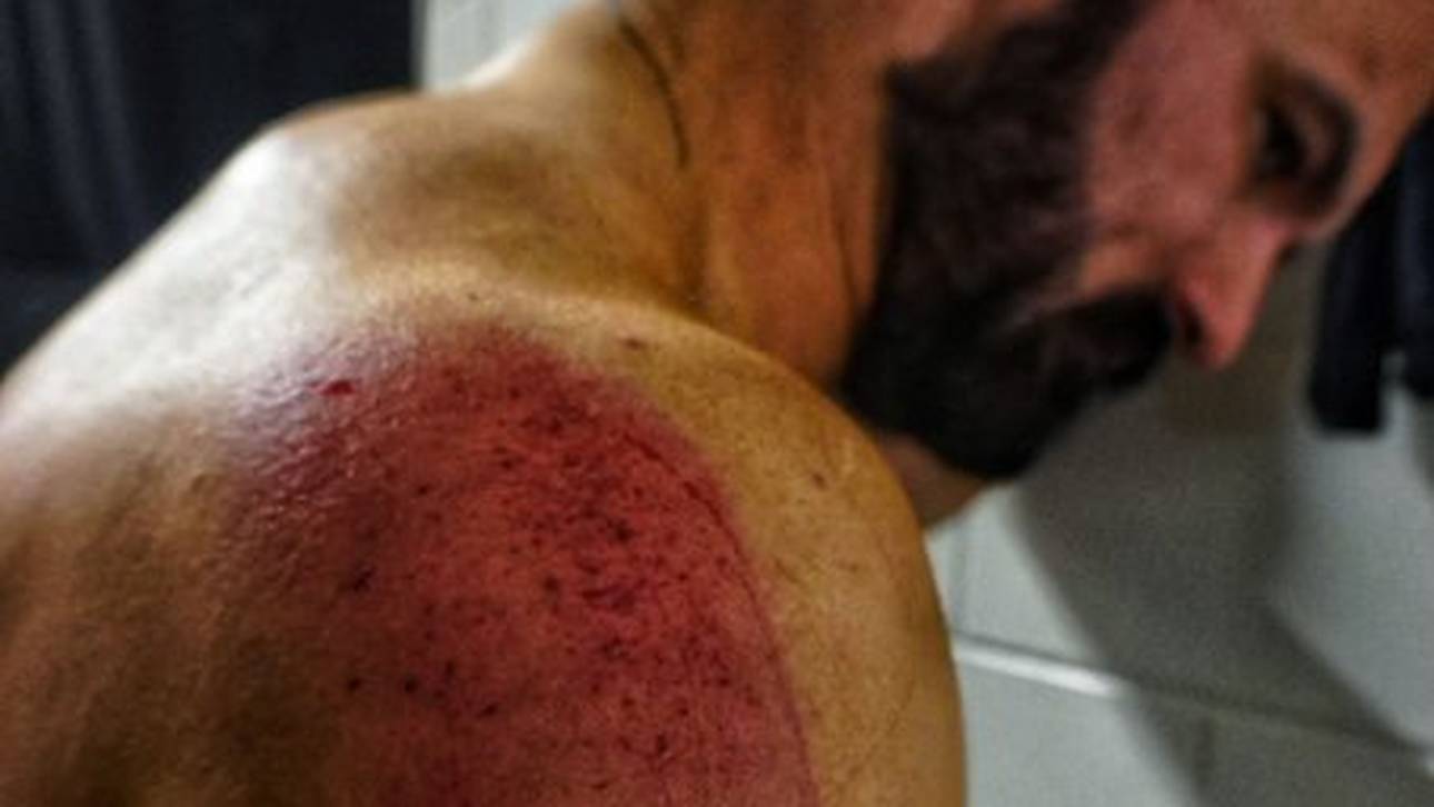 Brutale Szenen: WWE postet Schock-Bild