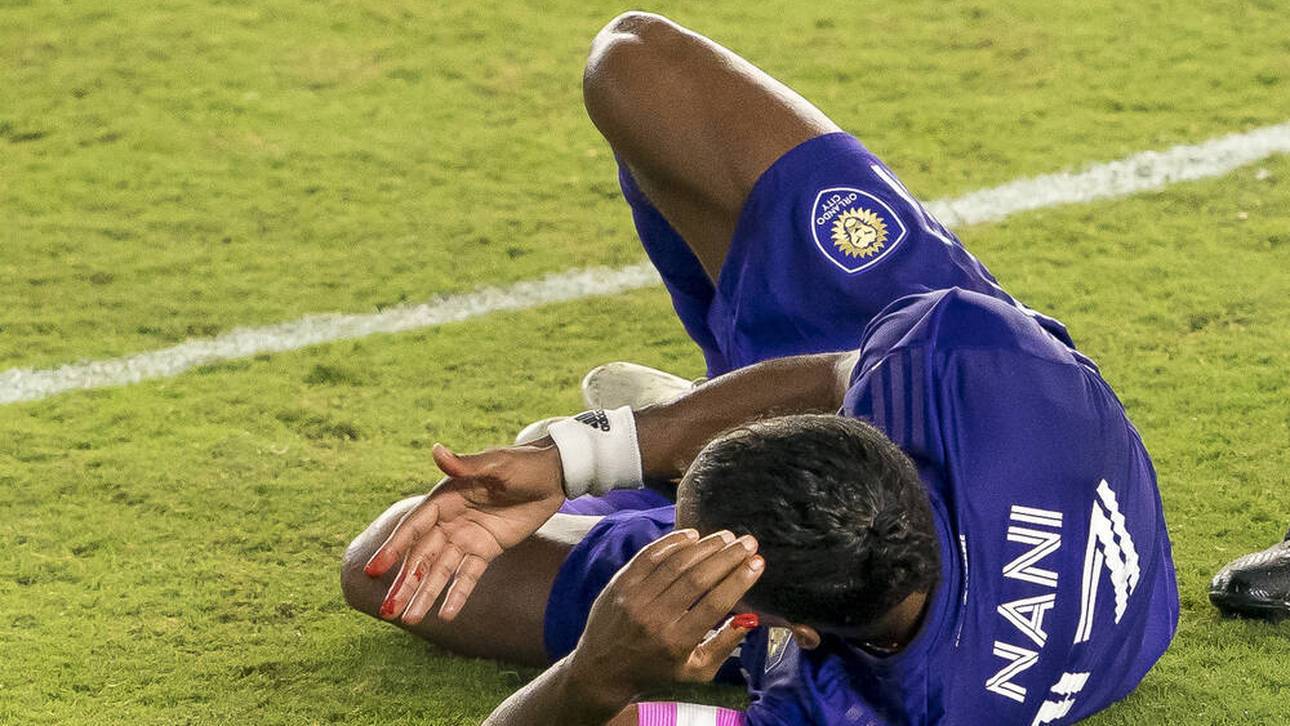 MLS treibt Wechsel-Revolution voran