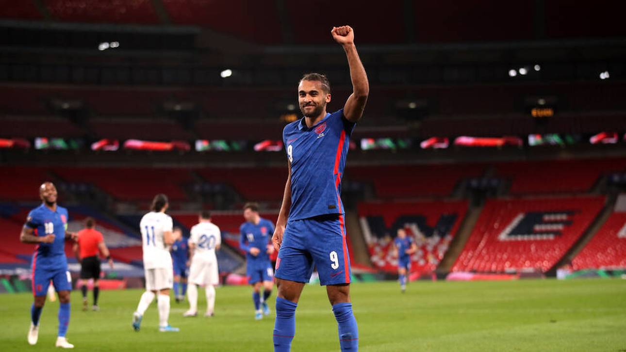 Fans veralbern England-Star