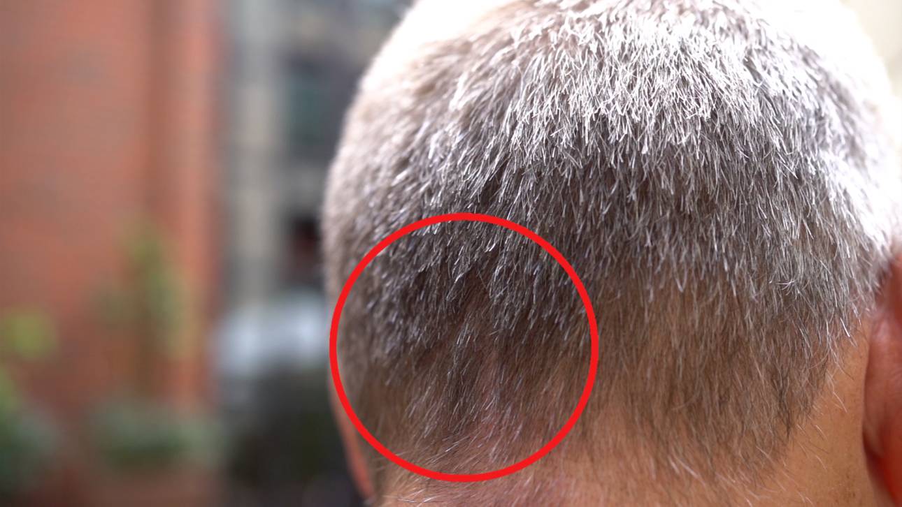 Alexander Zorniger hat sich eine 1 in seine Haare rasieren lassen