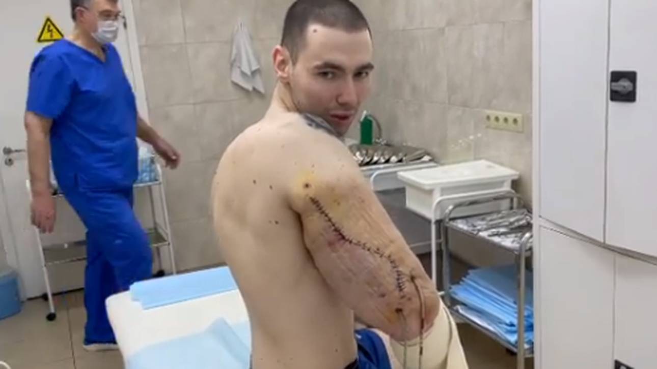 Ex-MMA-Kämpfer bangt um Arme