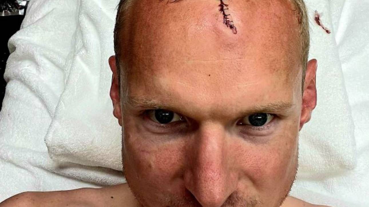 SGE-Held Rode postet Wundenbild