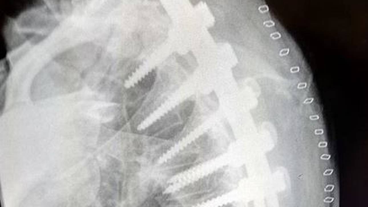 Üble Verletzung: Star zeigt Bilder