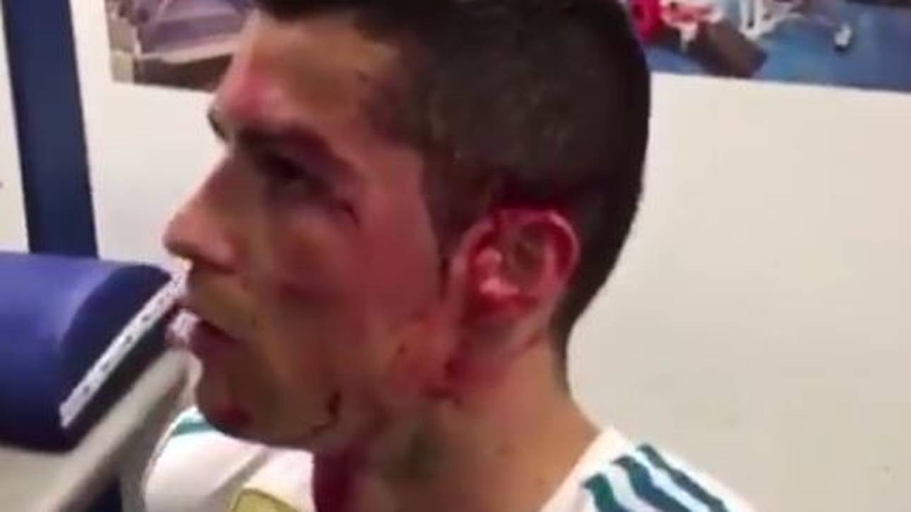 Real postet Ronaldo-Schockvideo