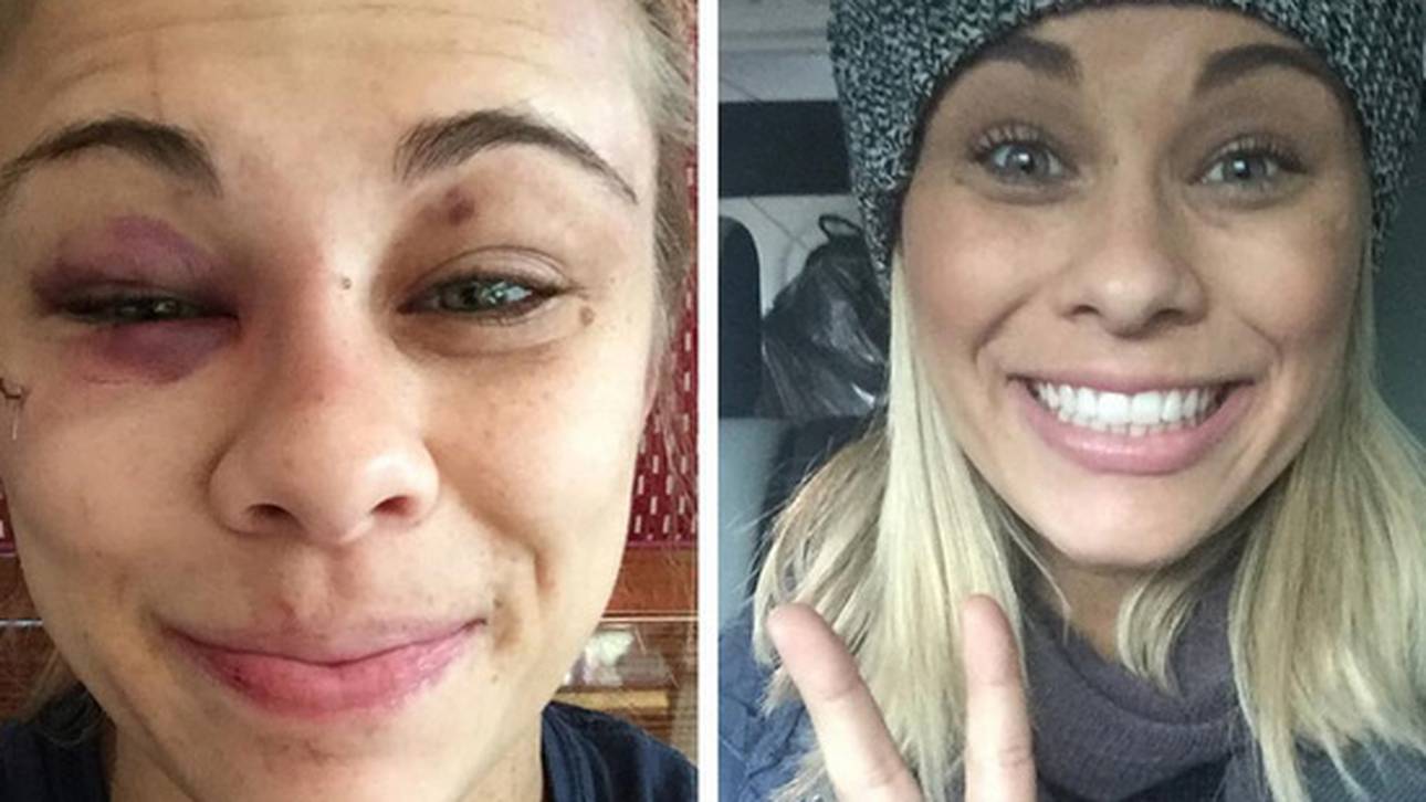 Blitzheilung bei UFC-Star