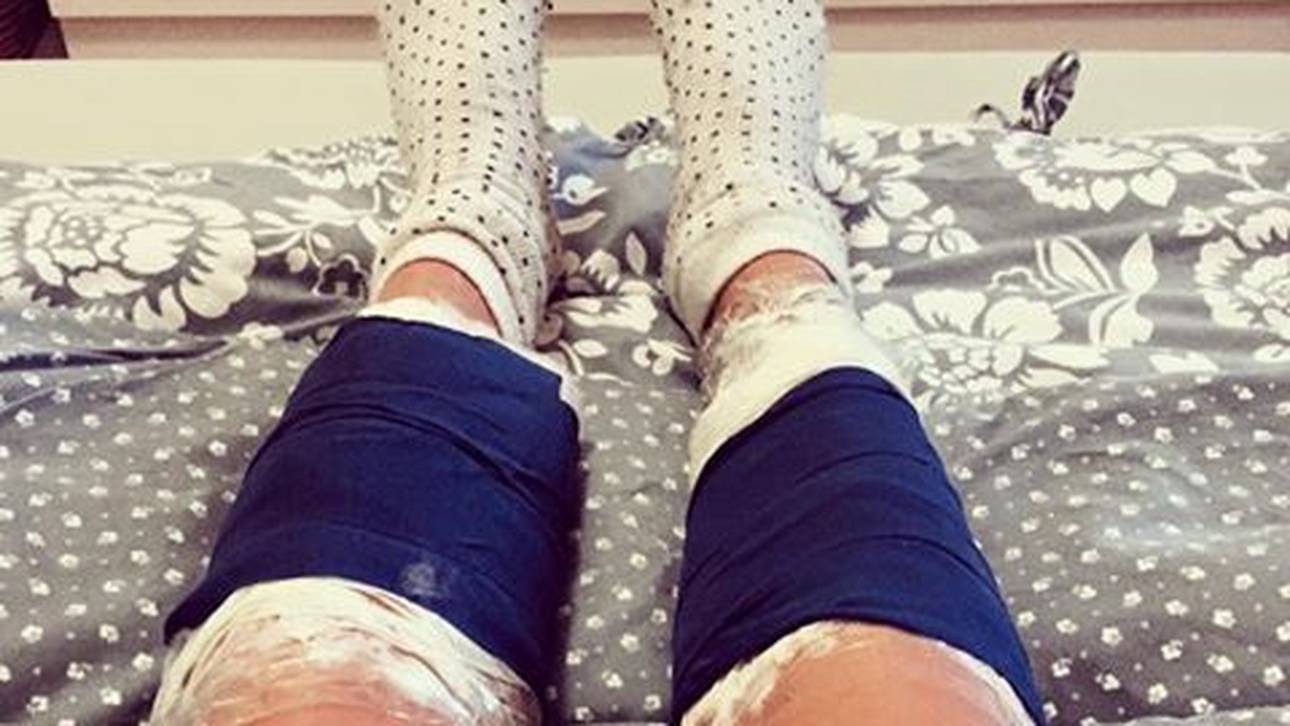 Kuriose Verletzung bei Gössner