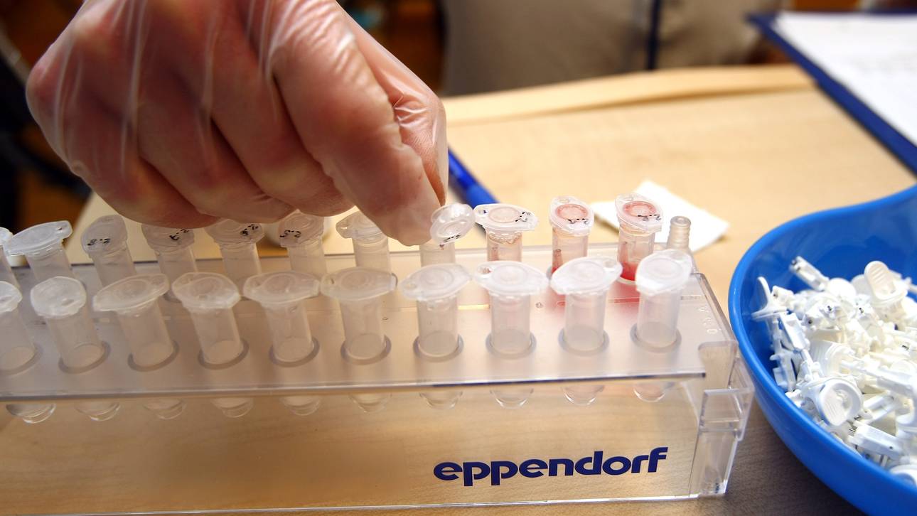 NADA lobt Blutstropfen-Dopingtest