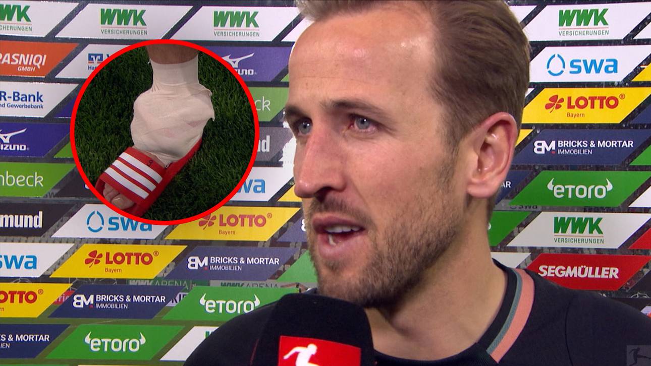 Knöchel dick! Kane gibt Prognose