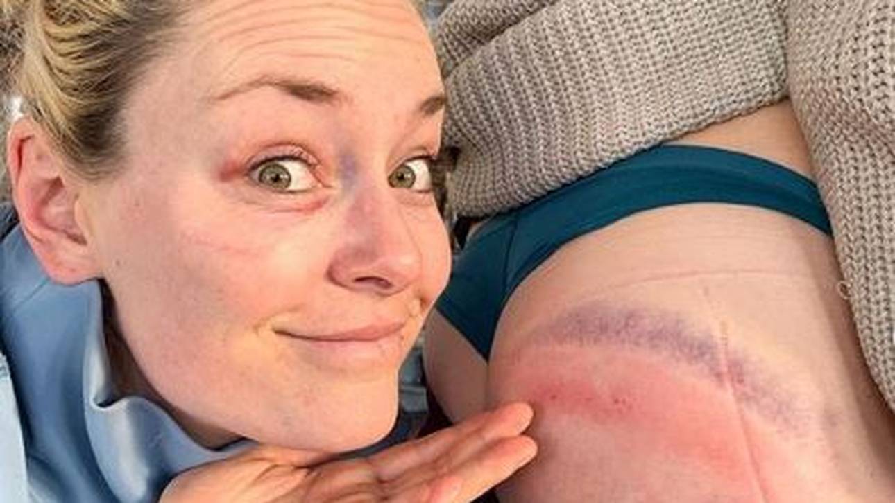 Vonn und Ross zeigen Sturz-Spuren