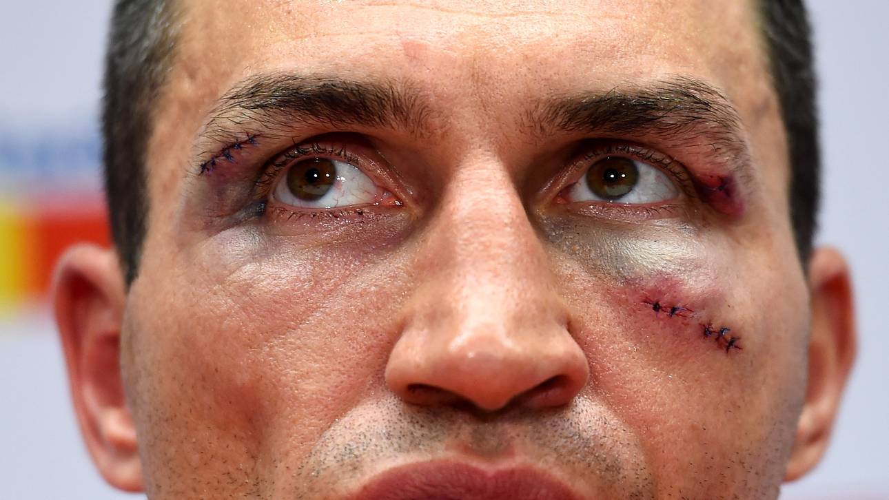 Klitschko zieht Rückkampfoption