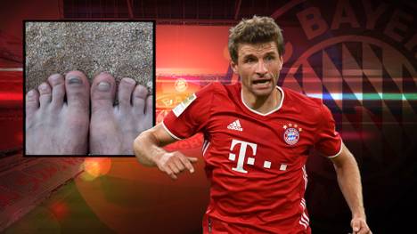 Auf Instagram gewährte Thomas Müller offene einen Blick auf seine kostenbaren Füße. Ein ehemaliger Münchner scherzt über dieses Bild.