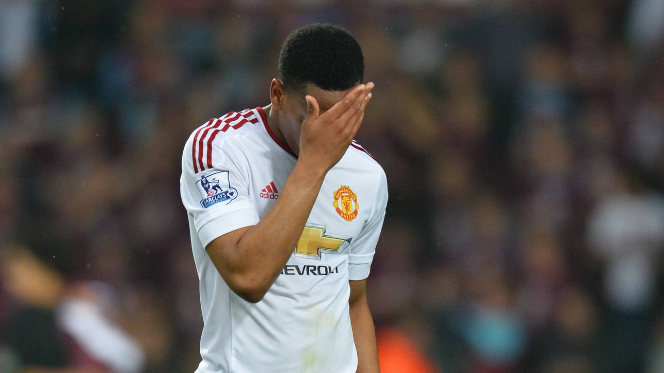 Panne: Martial leakt United-Trikot
