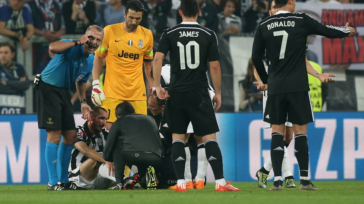 Schiedsrichter Martin Atkinson muss das Spiel unterbrechen, weil sich Juventus-Verteidiger Giorgio Chiellini eine Platzwunde direkt am Auge zugezogen hat