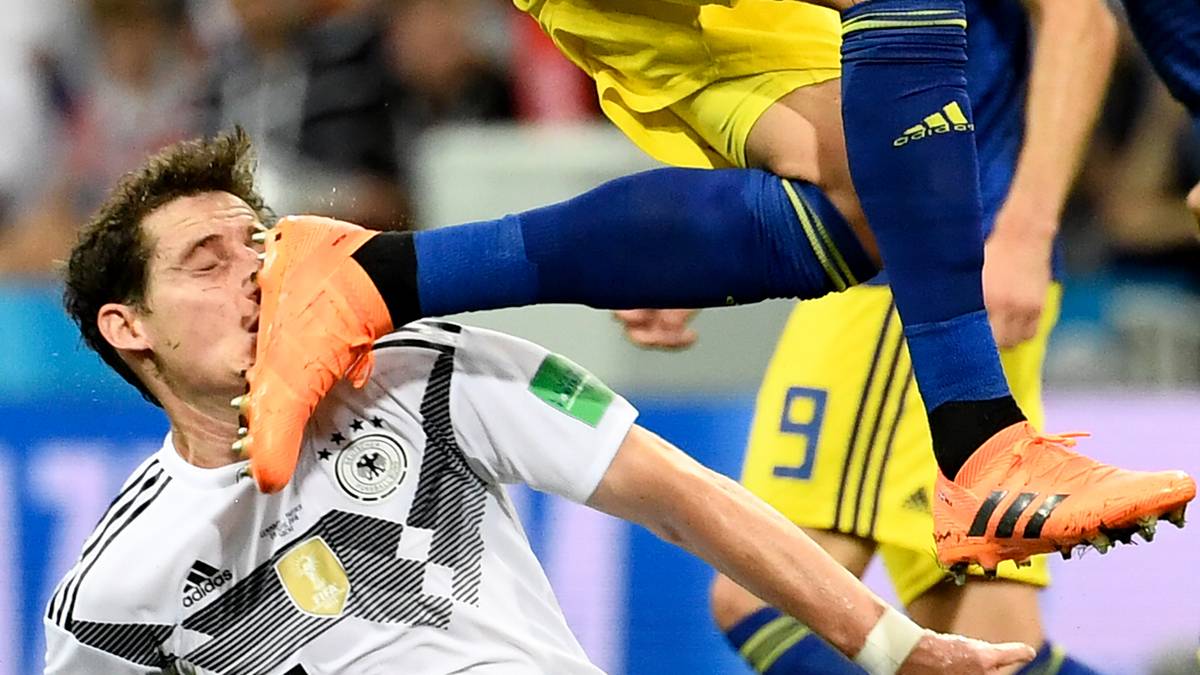 DEUTSCHLAND vs. SCHWEDEN: 2:1 - Im zweiten Gruppenspiel gegen Schweden stand das DFB-Team damit schon mit dem Rücken zur Wand. Das Spiel in Sotschi sollte zum Drama werden: Erst musste Sebastian Rudy, der neu ins Team gekommen war, nach diesem Tritt mit einem Nasenbeinbruch vom Platz