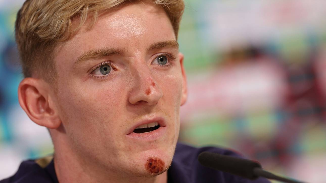 Gestürzter England-Star gibt Update