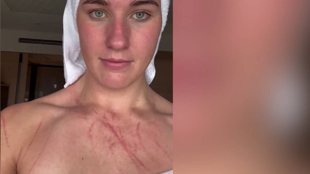 EM: Wasserballerinnen mit Auftaktsieg