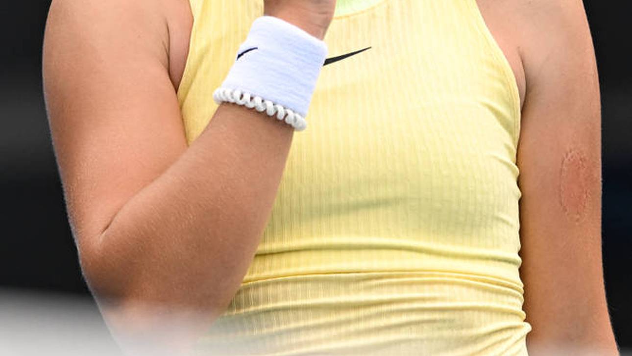 Bissspur! Wunderkind verliert Fassung