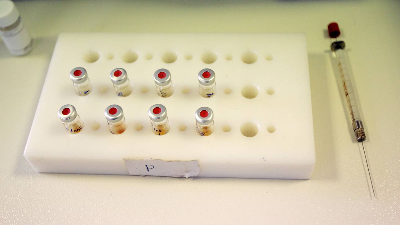 Neues Verfahren bei Doping-Tests