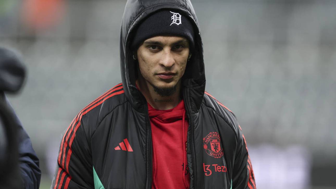 Manchesters 95-Millionen-Flop