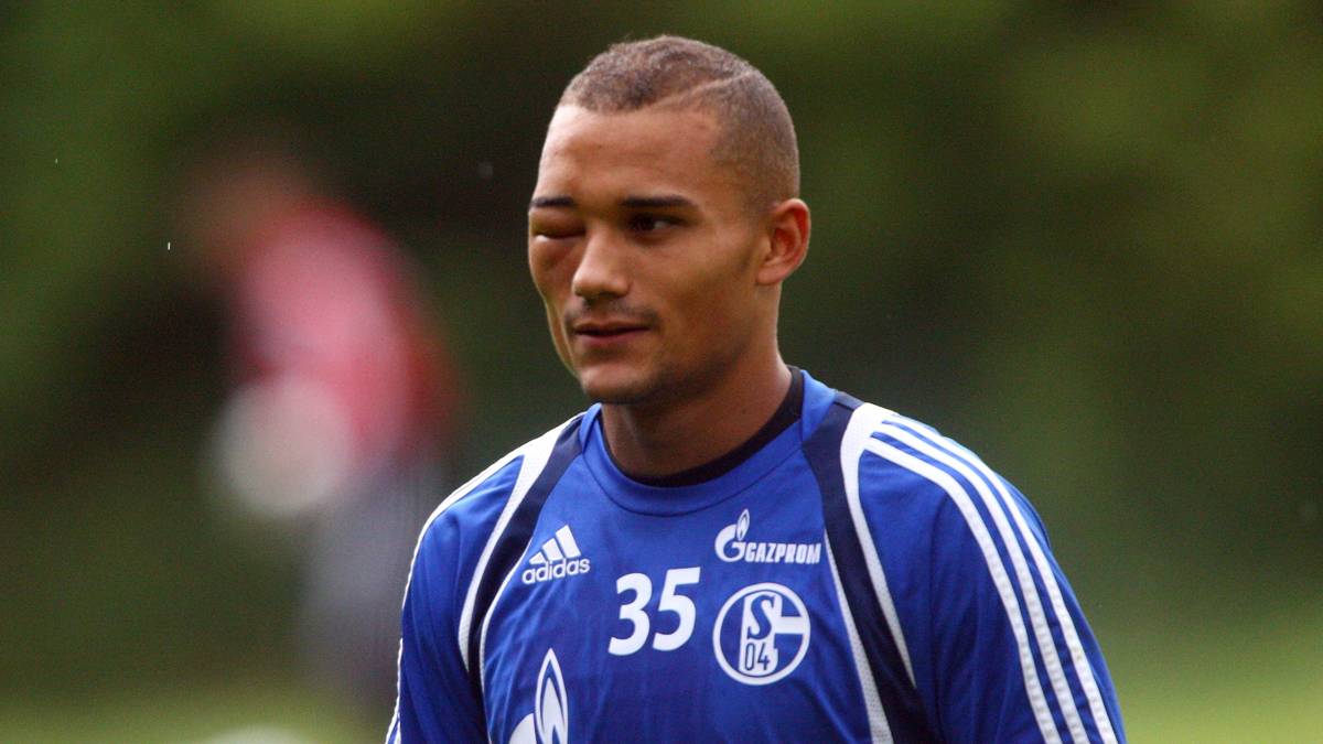 Bei Mohamed Amsif ist kein eifersüchtiger Ehemann oder ein gemeiner Gegenspieler am Werk. Ein Moskito sorgt für das stark zugeschwollene Auge des Ex-Schalkers 