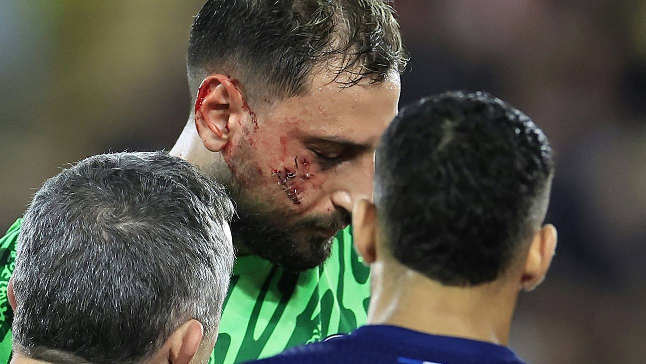 PSG-Stars kritisieren Schiedsrichter