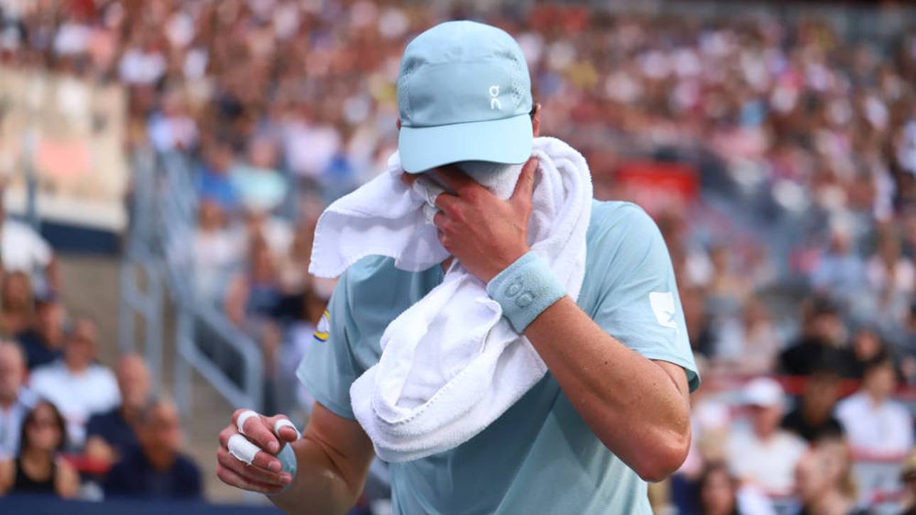 Nächster Star sagt für US Open ab