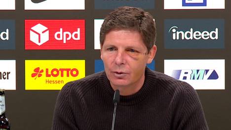 Frankfurt ist in der ersten Halbzeit gegen den BVB lange Zeit überlegen, verpasst das 3:0 und verliert schlussendlich das Spiel. Die Frage nach dem Warum kann auch Oliver Glasner nicht beantworten.