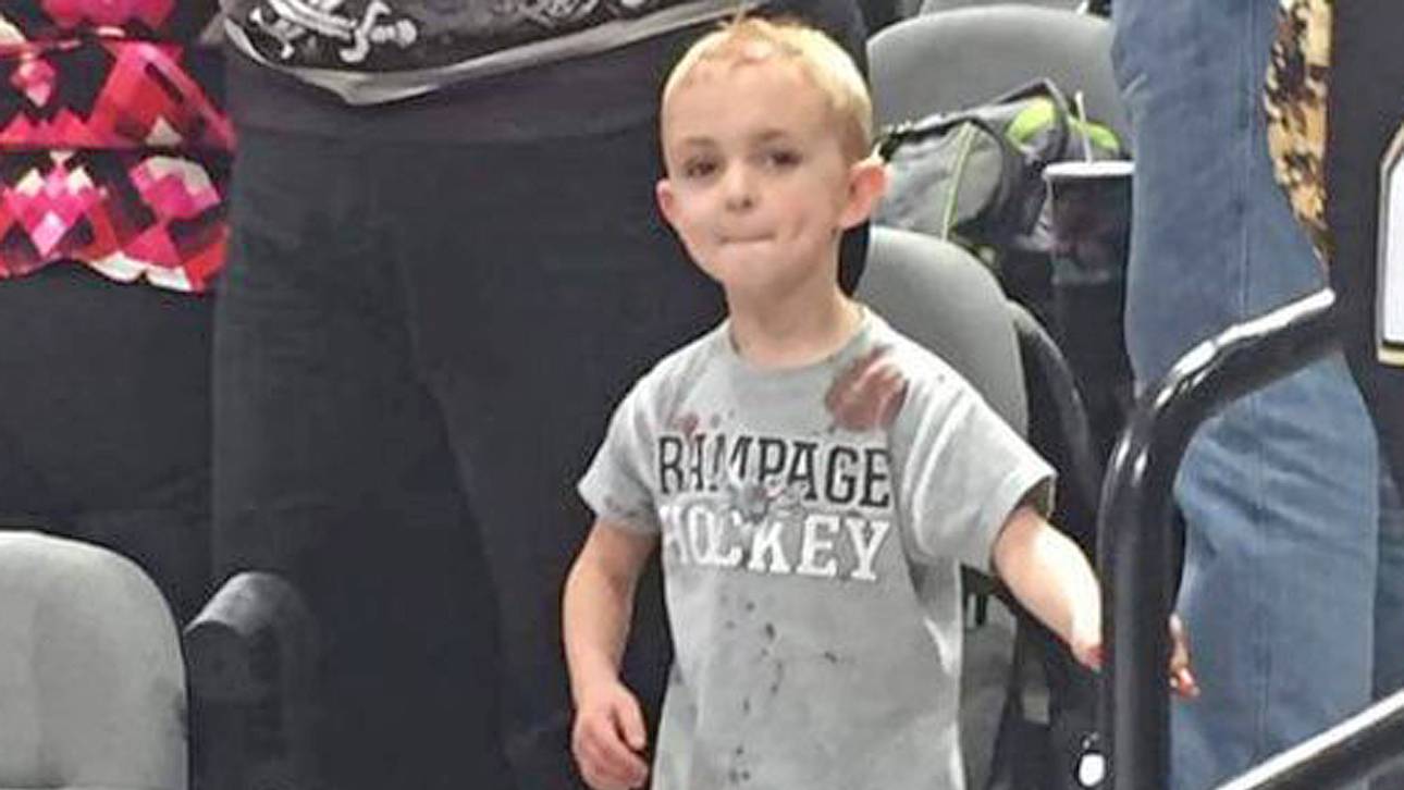 Fünfjähriger steckt Puck-Treffer weg