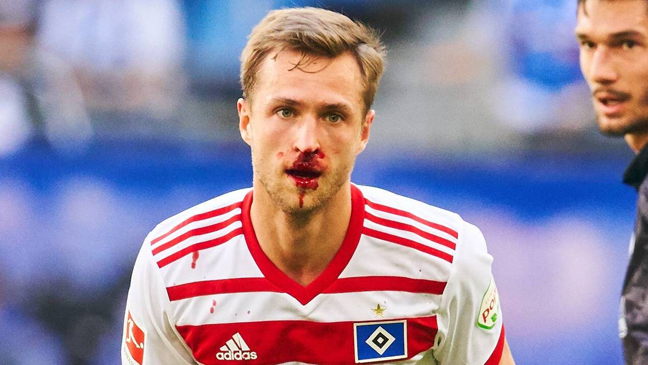 Blut-Zwischenfall bringt HSV in Not