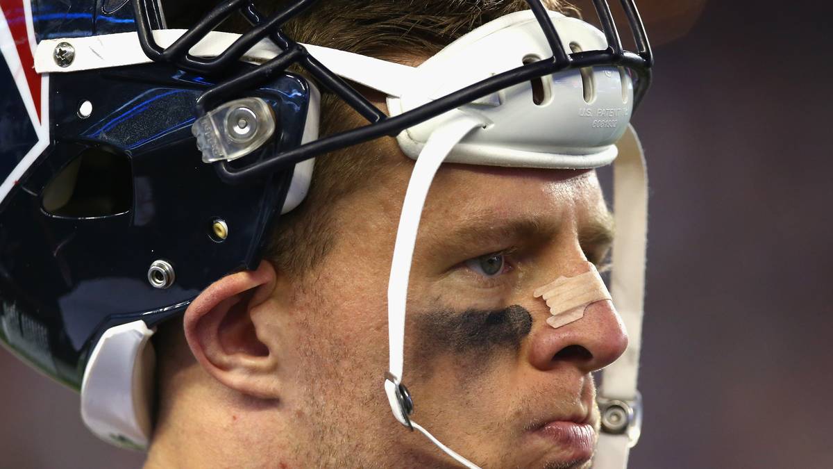 J.J. WATT: Abwehr-Star J.J. Watt von den Houston Texans hatte in den vergangenen Jahren immer wieder mit Verletzungen zu kämpfen. Diese Saison ist für ihn aufgrund einer Rückenverletzung schon gelaufen