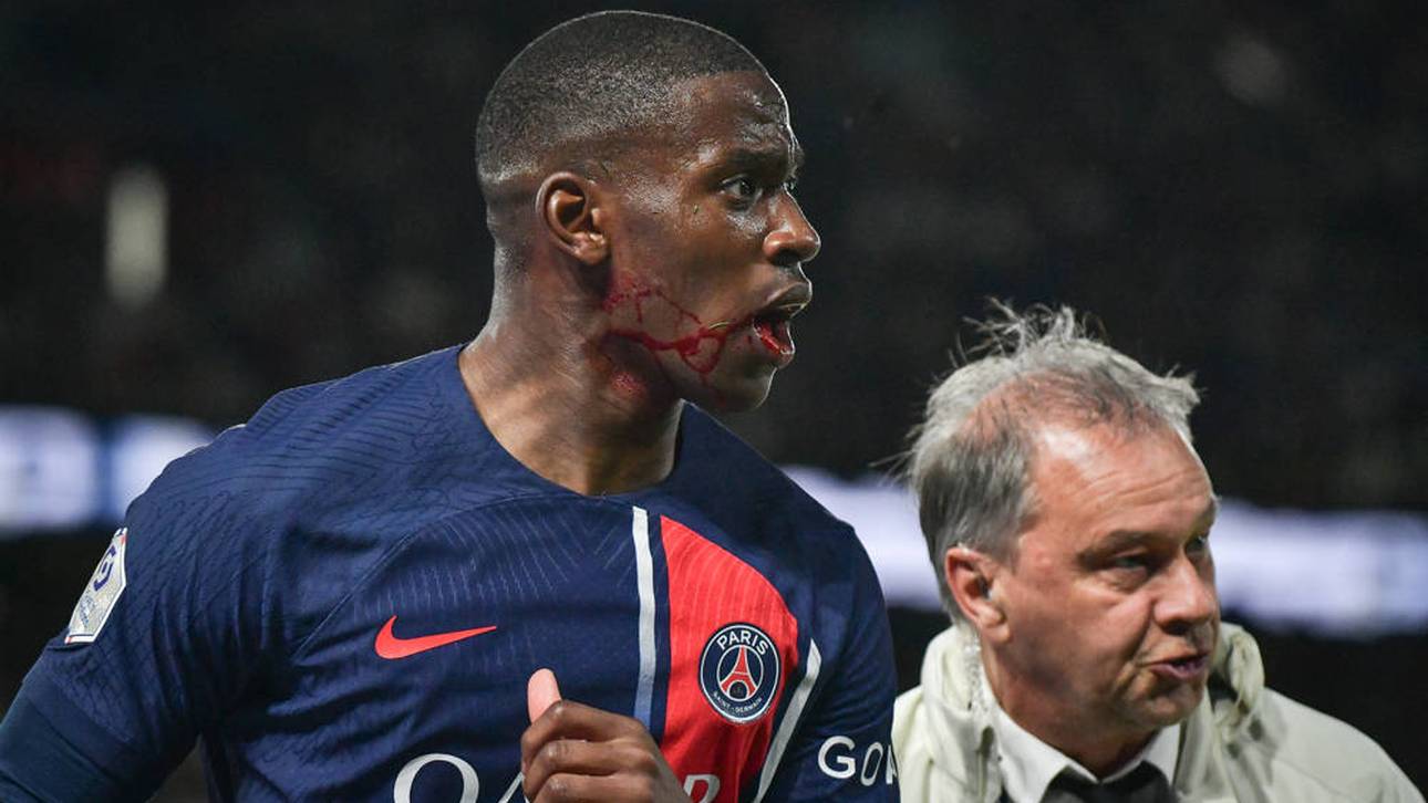 Blutender Star nach Wechsel sauer