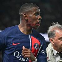 Schlimme Szene beim 1:1 von Paris Saint-Germain gegen Clermont Foot. Nodri Mukiele prallt mit Gäste-Torwart Massamba N‘Diaye zusammen.