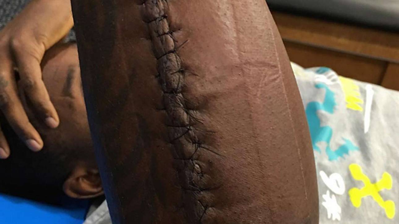 Verletzter Panther zeigt Schock-Bild