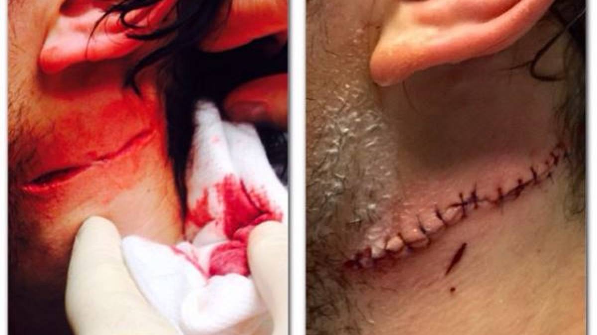 Übel erwischt es auch Michael Del Zotto von den Philadelphia Flyers. Colorado Avalanche-Stürmer Danny Briere fällt in der Folge eines Zweikampf über Del Zotto und schlitzt ihm dabei mit der Kufe seines Schlittschuhs den Hals auf. Die Wunde wird mit 20 Stichen genäht