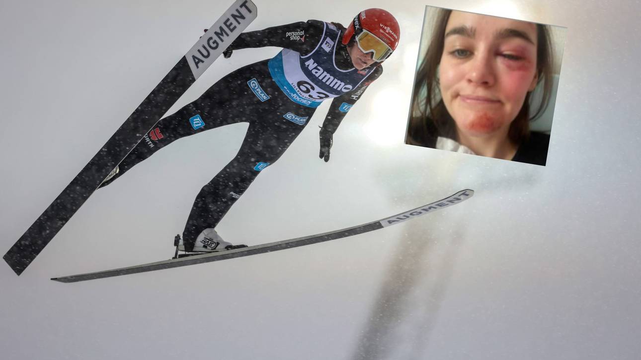 DSV-Star enthüllt schweren Sturz