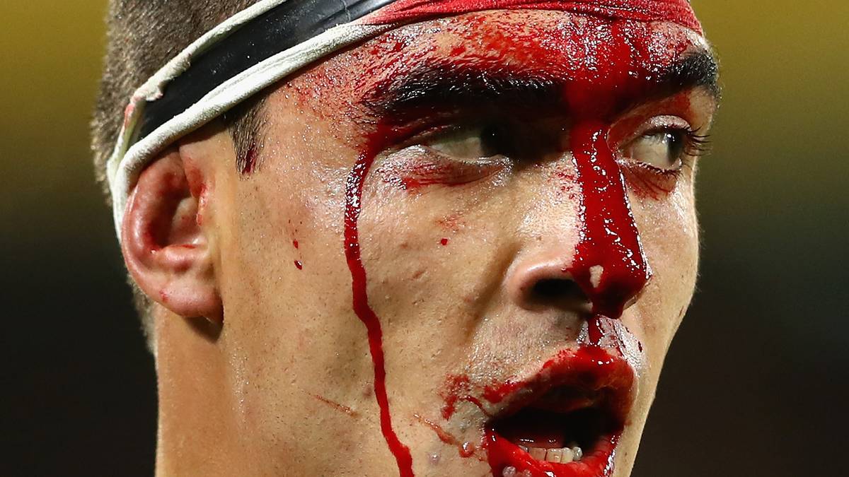 Nein, das ist kein Halloween-Outfit. Rory Arnold von den australischen "Wallabies" musste im Test gegen England im Juni 2016 mächtig einstecken