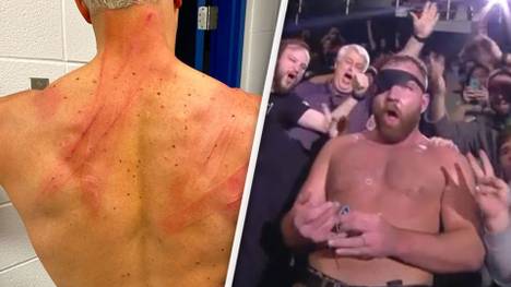 Cody Rhodes (l.) musste sich einer brutalen Gürtel-Attacke unterziehen
