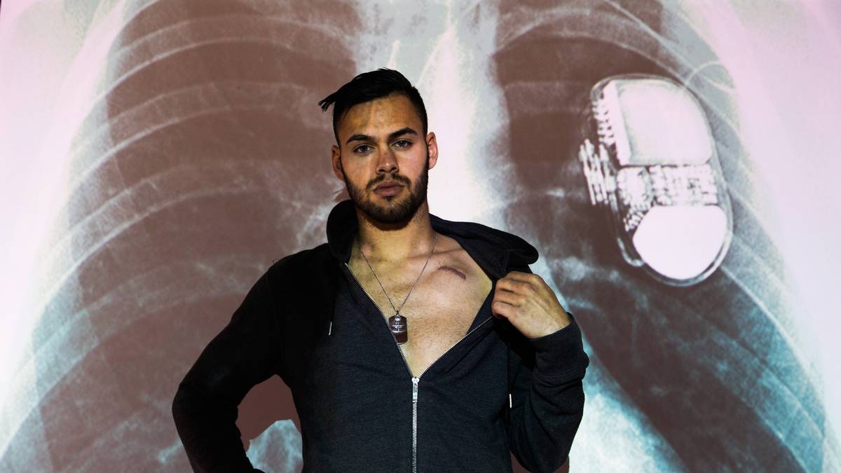 Nach vier Operationen gab er im November 2014 mit einem Defibrillator in der Brust sein Comeback - ein Novum im deutschen Fußball. Im Oktober 2017 beendete er nach erneuten Herzproblemen seine Karriere