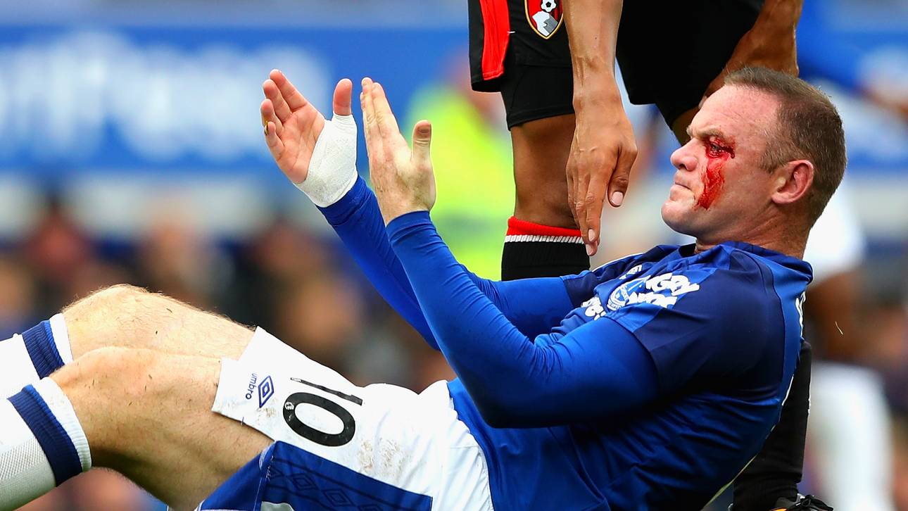 Angst um blutenden Rooney