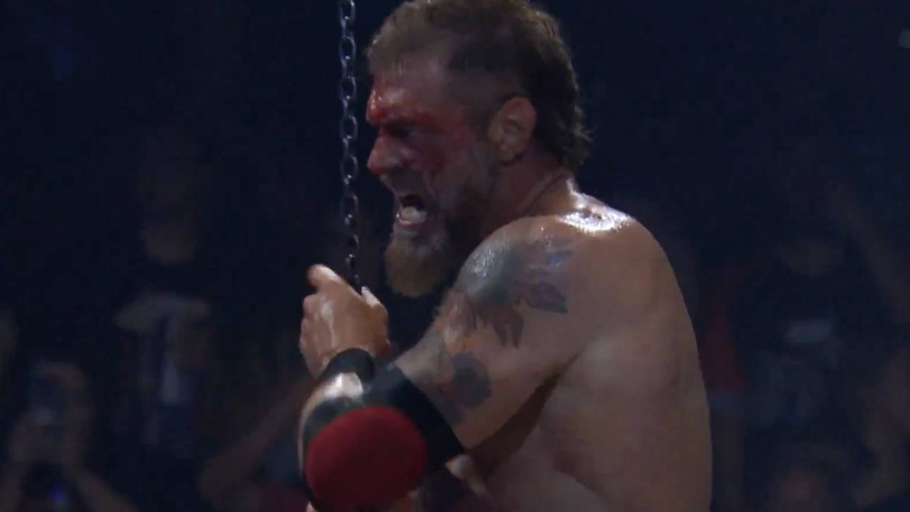 Knochenbruch-Drama um Legende