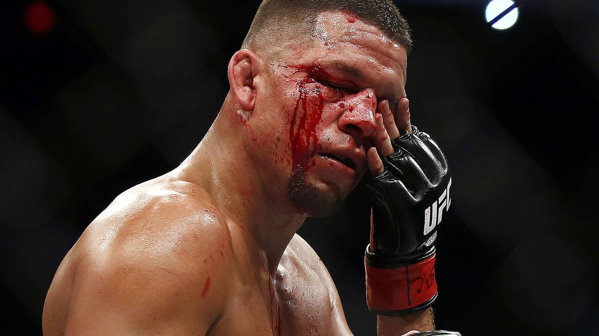 Besonders eine Platzwunde unter dem rechten Auge schränkte Diaz' Sicht in der Folge deutlich ein